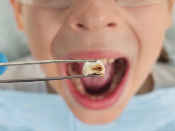Best Emergency Pediatric Dental Care in St Paul, TX